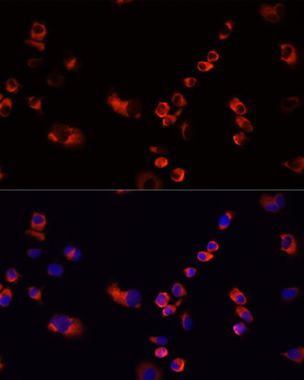 EEF1G Antibody in Immunocytochemistry (ICC/IF)