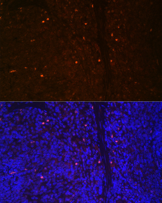 RUNX2 Antibody in Immunocytochemistry (ICC/IF)