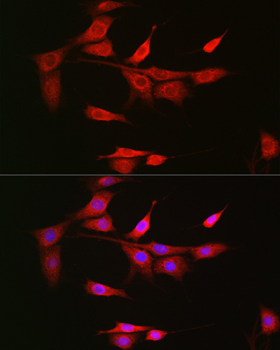 NOTCH3 Antibody in Immunocytochemistry (ICC/IF)