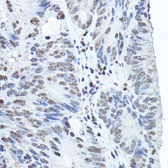 TWIST1 Antibody in Immunohistochemistry (Paraffin) (IHC (P))