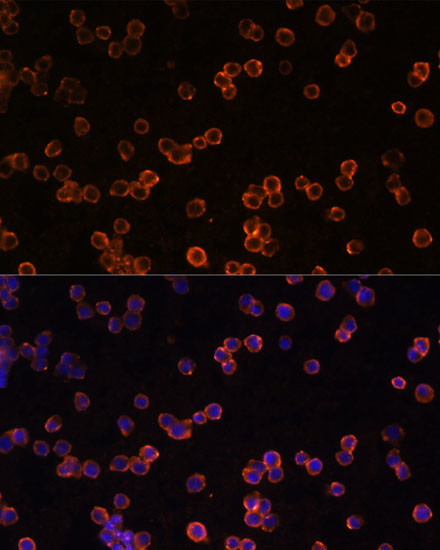 CD39 Antibody in Immunocytochemistry (ICC/IF)