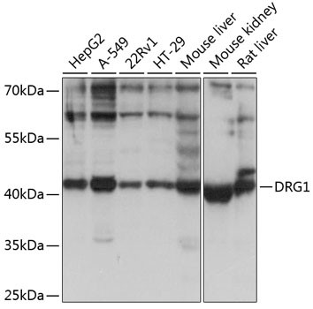 DRG1 Antibody in Western Blot (WB)