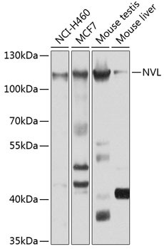 NVL Antibody in Western Blot (WB)