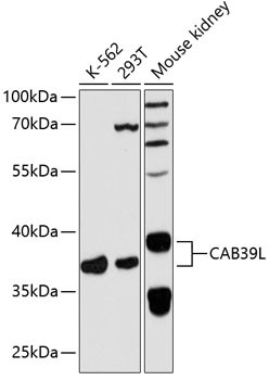 CAB39L Antibody in Western Blot (WB)