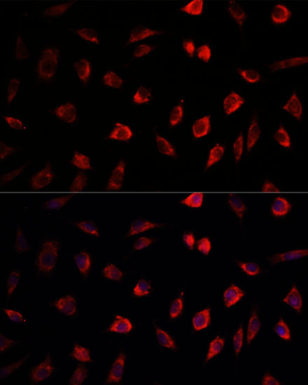 NEDD1 Antibody in Immunocytochemistry (ICC/IF)