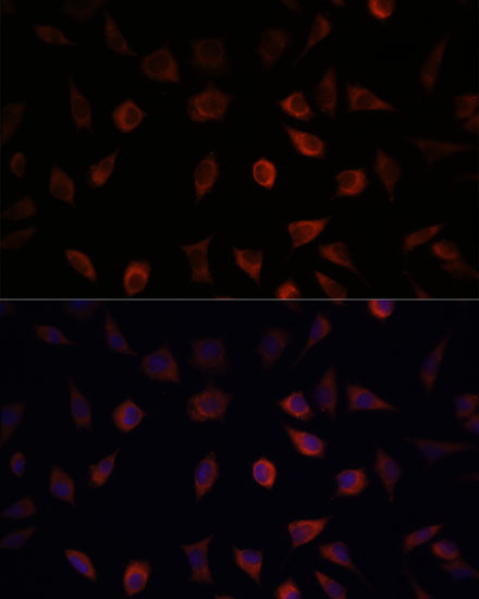 FABP1 Antibody in Immunocytochemistry (ICC/IF)