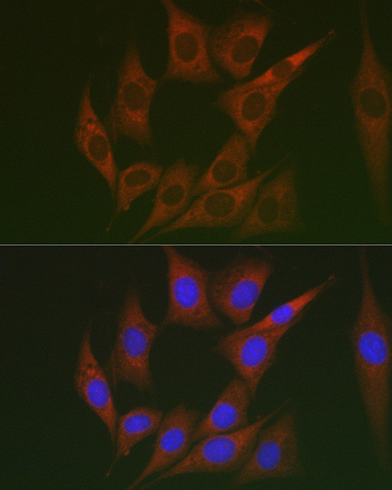 LUM Antibody in Immunocytochemistry (ICC/IF)