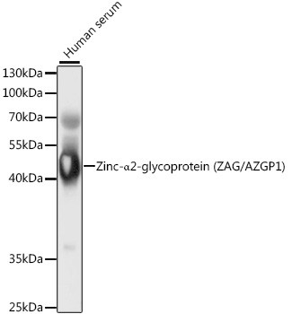 AZGP1 Antibody in Western Blot (WB)