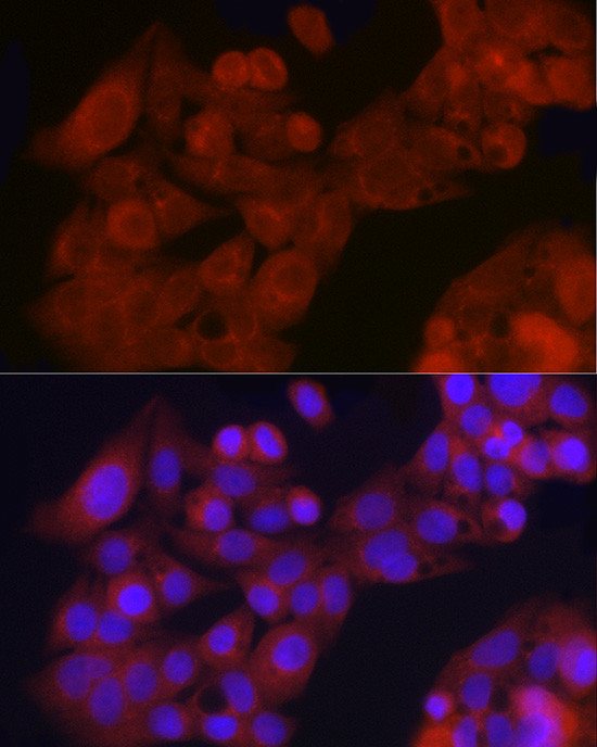 GFR alpha-1 Antibody in Immunocytochemistry (ICC/IF)