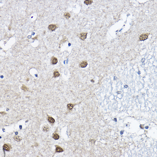 ORC6 Antibody in Immunohistochemistry (Paraffin) (IHC (P))