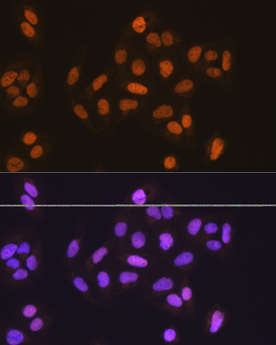 MCM5 Antibody in Immunocytochemistry (ICC/IF)