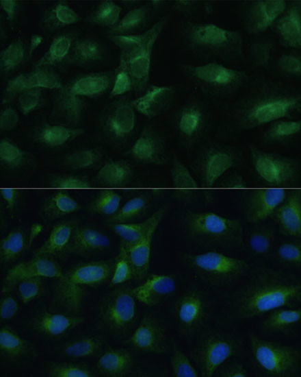 PGRMC1 Antibody in Immunocytochemistry (ICC/IF)