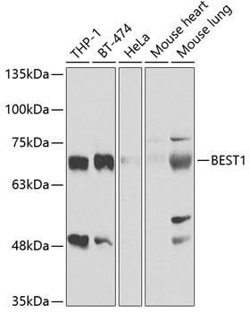 Bestrophin 1 Antibody in Western Blot (WB)