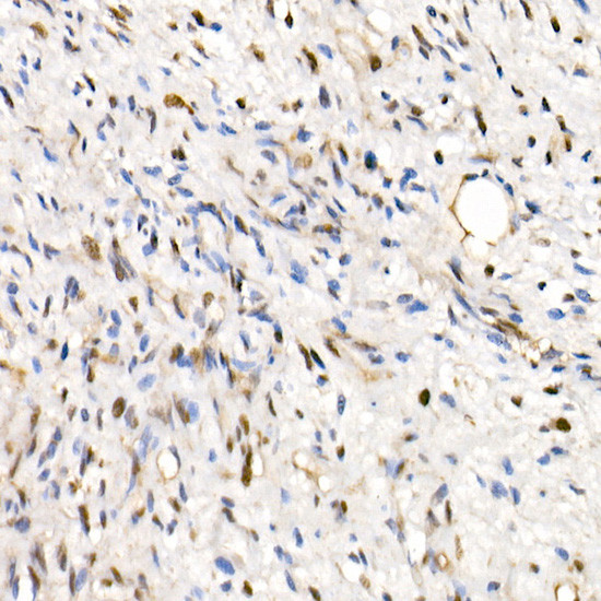 SMARCB1 Antibody in Immunohistochemistry (Paraffin) (IHC (P))