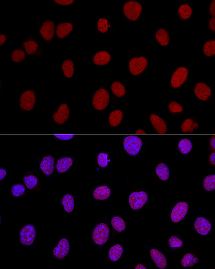 Ku80 Antibody in Immunocytochemistry (ICC/IF)
