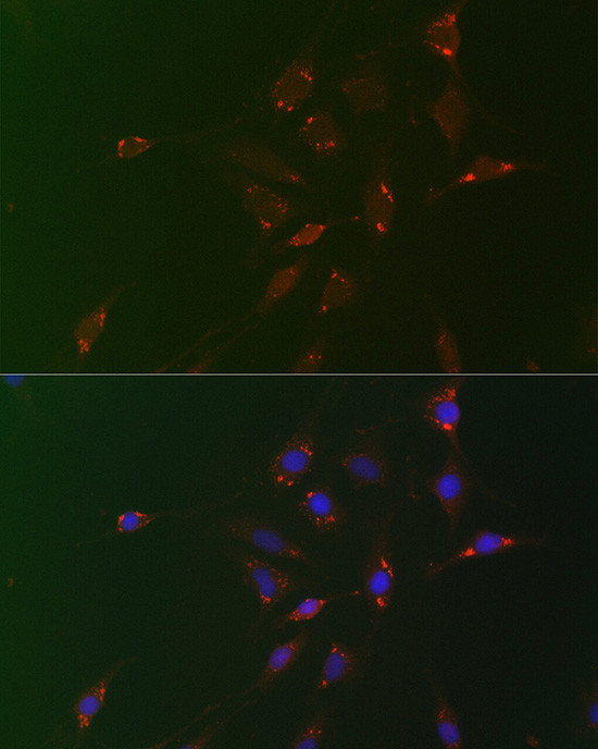 ADFP Antibody in Immunocytochemistry (ICC/IF)