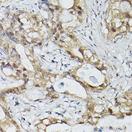 ELF3 Antibody in Immunohistochemistry (Paraffin) (IHC (P))