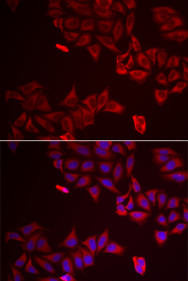 Galectin 8 Antibody in Immunocytochemistry (ICC/IF)