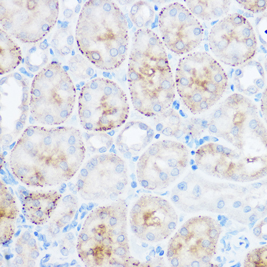 Monoacylglycerol Lipase Antibody in Immunohistochemistry (Paraffin) (IHC (P))