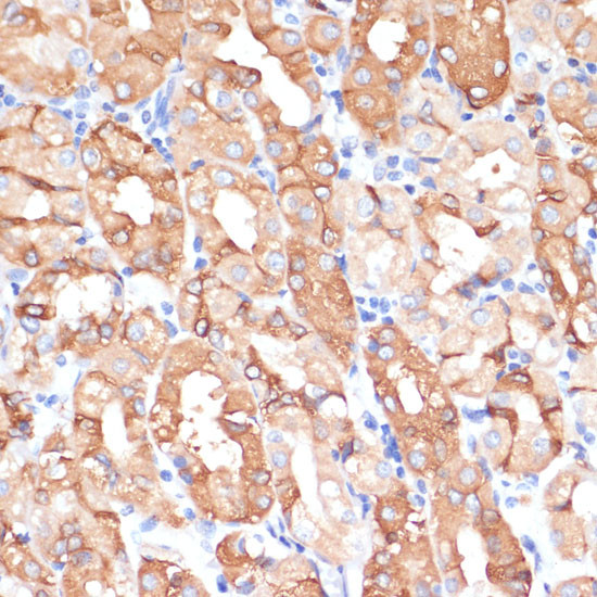 NHLRC1 Antibody in Immunohistochemistry (Paraffin) (IHC (P))