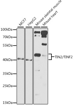 TIN2 Antibody in Western Blot (WB)