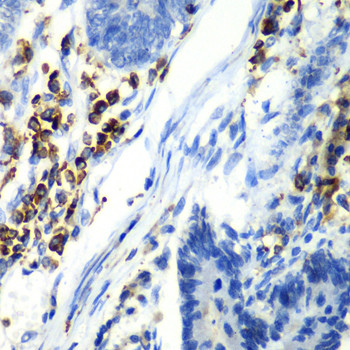 ASGR1 Antibody in Immunohistochemistry (Paraffin) (IHC (P))