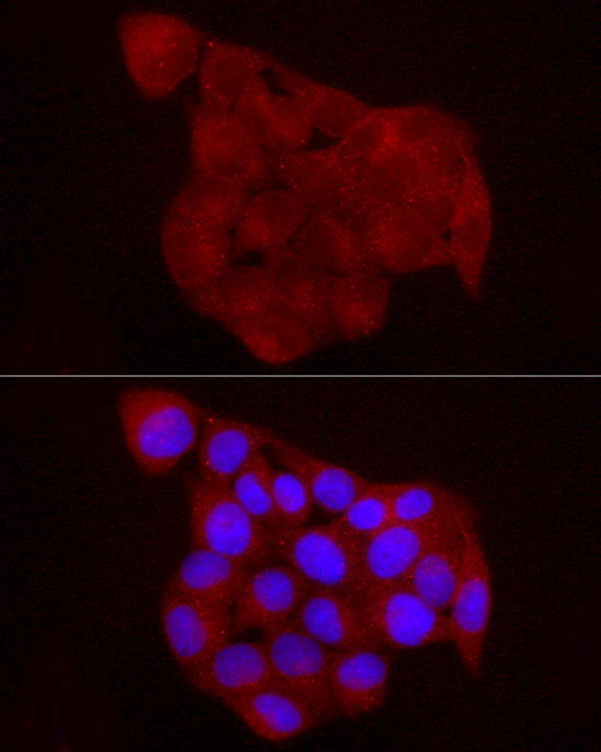 Chemerin Antibody in Immunocytochemistry (ICC/IF)