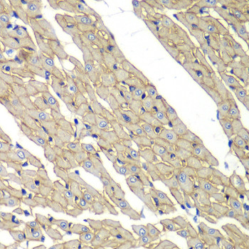 SGCD Antibody in Immunohistochemistry (Paraffin) (IHC (P))