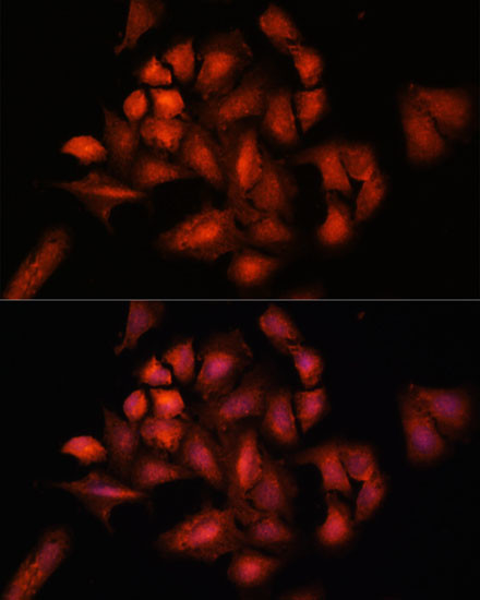 STAM2 Antibody in Immunocytochemistry (ICC/IF)