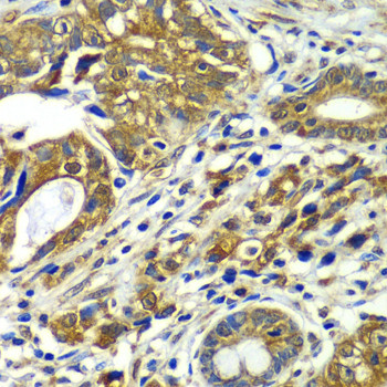 APC6 Antibody in Immunohistochemistry (Paraffin) (IHC (P))
