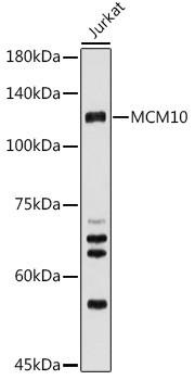 MCM10 Antibody in Western Blot (WB)