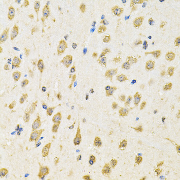 PTPRE Antibody in Immunohistochemistry (Paraffin) (IHC (P))
