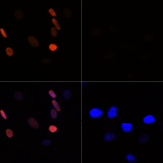 H3K56ac Antibody in Immunocytochemistry (ICC/IF)