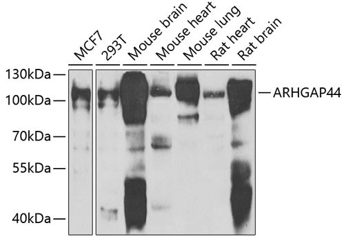 RICH2 Antibody in Western Blot (WB)