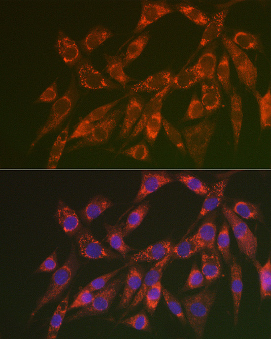 CHMP4B Antibody in Immunocytochemistry (ICC/IF)