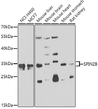 SPIN2 Antibody in Western Blot (WB)