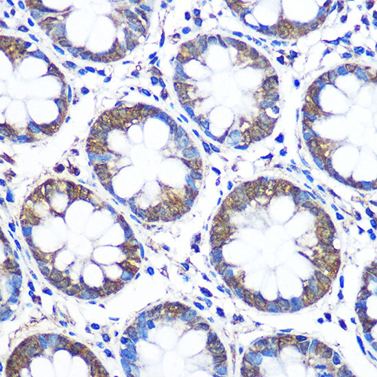WISP2 Antibody in Immunohistochemistry (Paraffin) (IHC (P))
