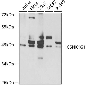 CK1 gamma-1 Antibody in Western Blot (WB)