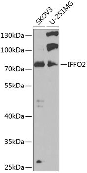 IFFO2 Antibody in Western Blot (WB)