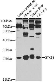 STK19 Antibody in Western Blot (WB)