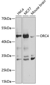 ORC4 Antibody in Western Blot (WB)