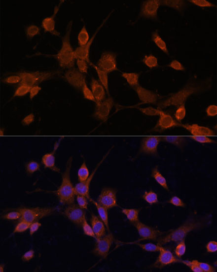 MEK3 Antibody in Immunocytochemistry (ICC/IF)