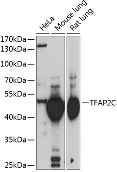 AP2 gamma Antibody in Western Blot (WB)