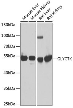 GLYCTK Antibody in Western Blot (WB)