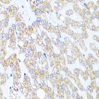 CHD1 Antibody in Immunohistochemistry (Paraffin) (IHC (P))