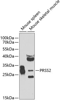 Trypsin 2 Antibody in Western Blot (WB)