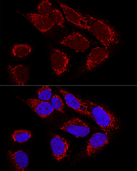 MTX2 Antibody in Immunocytochemistry (ICC/IF)