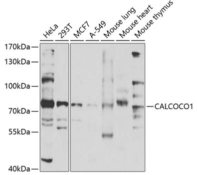 CALCOCO1 Antibody in Western Blot (WB)