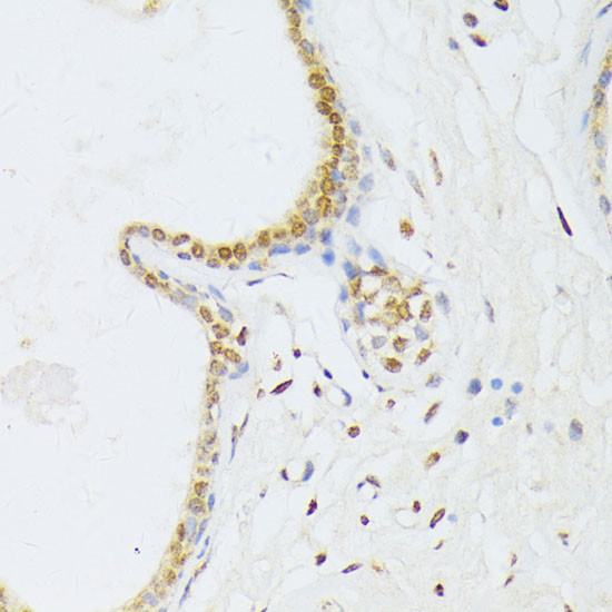 ANR52 Antibody in Immunohistochemistry (Paraffin) (IHC (P))