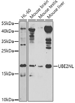 UBE2NL Antibody in Western Blot (WB)
